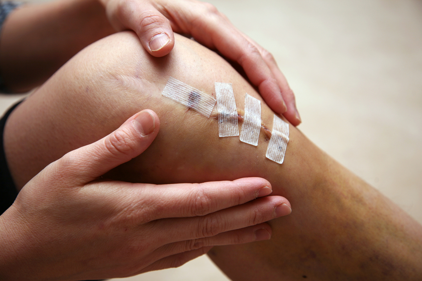 Knee Surgery vs. physical therapy